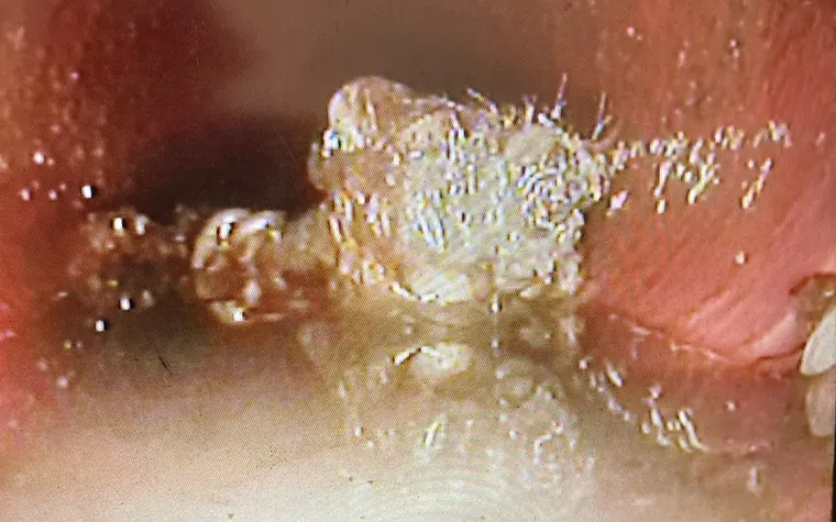 Live sewer camera view from inside a line